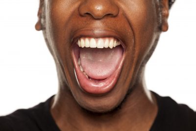How To Manage Burning Mouth Syndrome (BMS)
